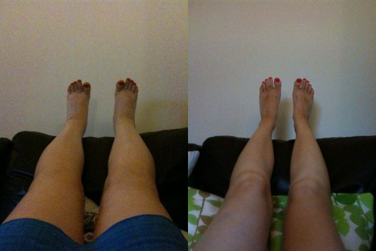 Brenda C. — before and after
